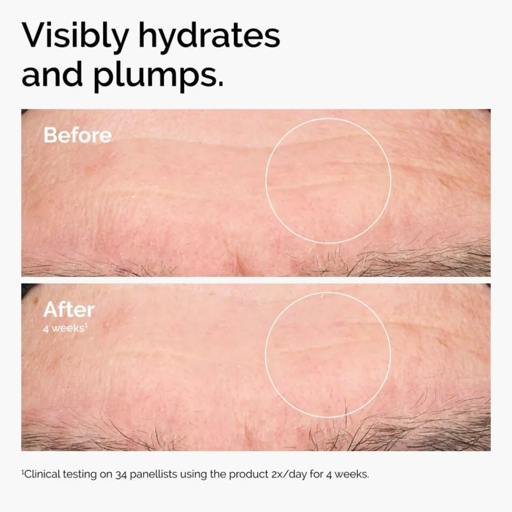 The Ordinary Hyaluronic Acid 2% + B5