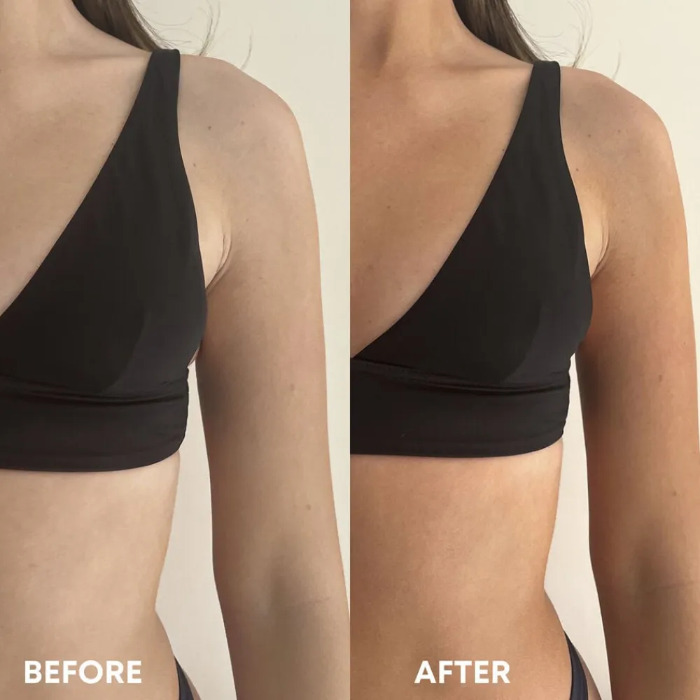 Tanning Mousse Medium 200 ml>Vita Liberata Best