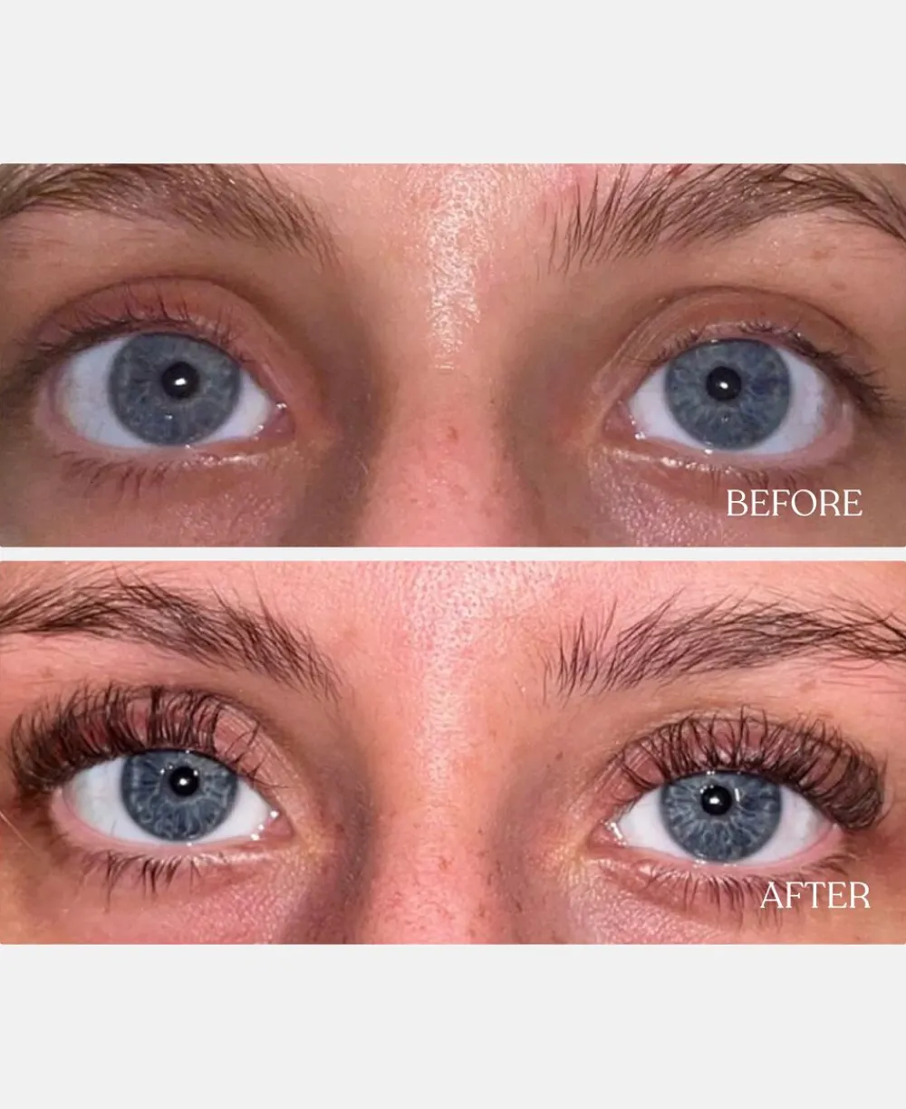 GLOWIE Copenhagen Vippeserum