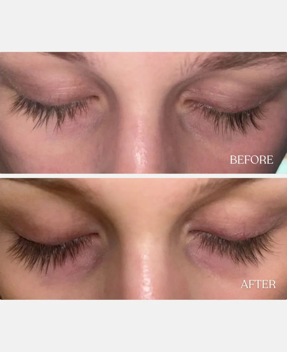 GLOWIE Copenhagen Vippeserum